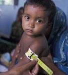 What is Malnutrition in Children?