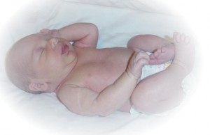 Newborn Skin Conditions and Rash Problems