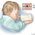 how to prevent tooth decay