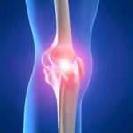 Causes of Knee Pain In Children