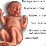 apgar test score newborn